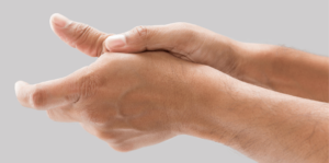 thumb sprain
